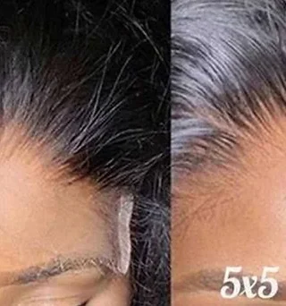 Closure customization